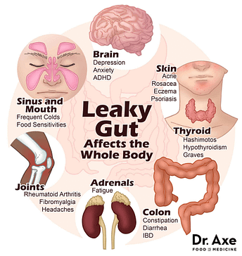 Leaky Gut